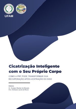 Cicatrização inteligente com seu próprio corpo: como a PRF pode transformar sua recuperação após a extração do siso