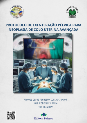 Protocolo de exenteração pélvica para neoplasia de colo uterina avançada